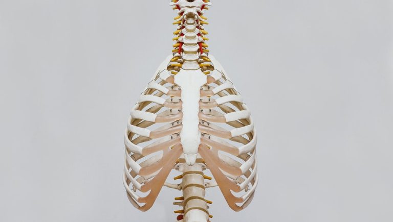 can pilates help scoliosis